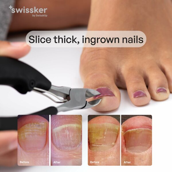 Heavy Duty toenail Clippers | Nail Clippers for Thick Nails - Image 7