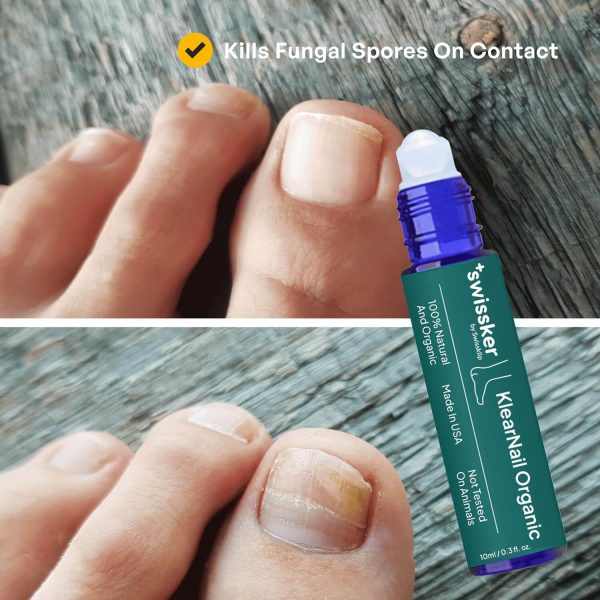 KlearNail Anti-Fungal Stick - Image 3