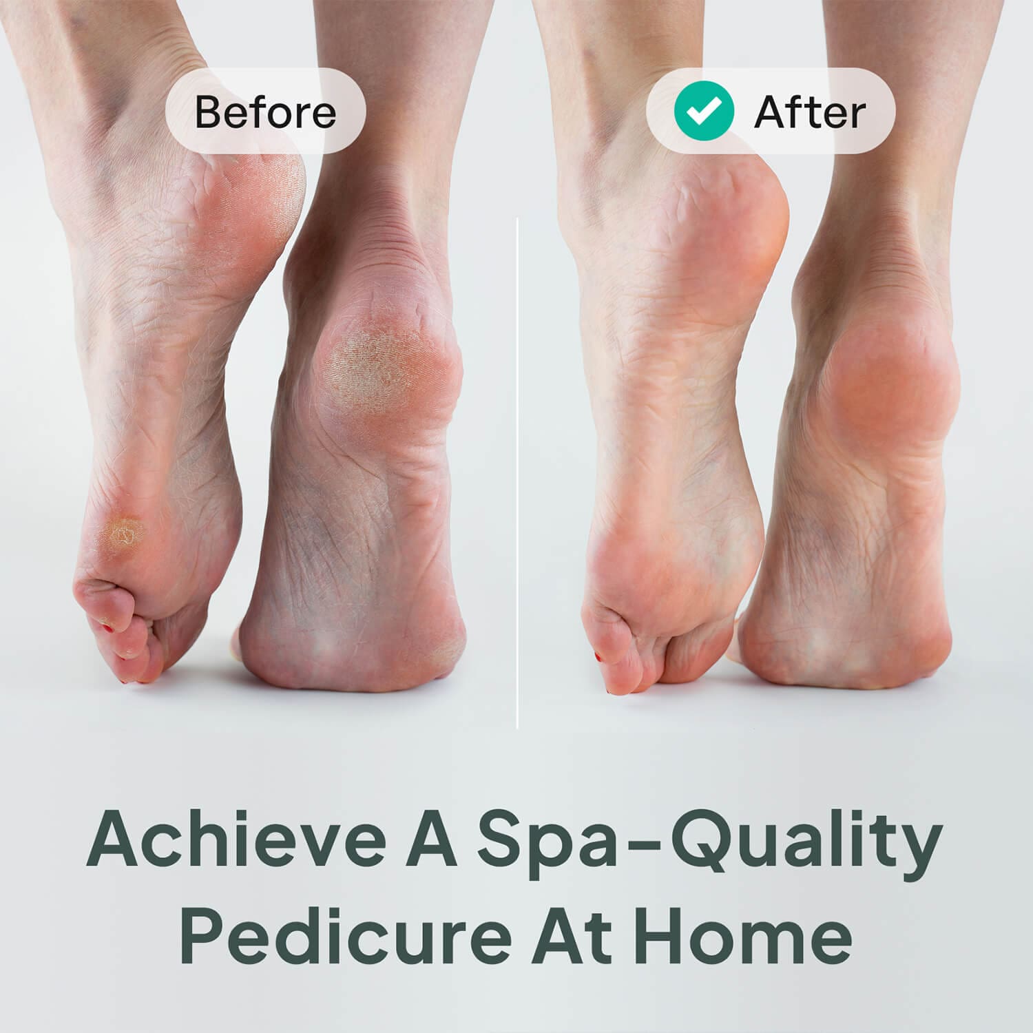 Foot Scrubber Callus Remover - Image 4