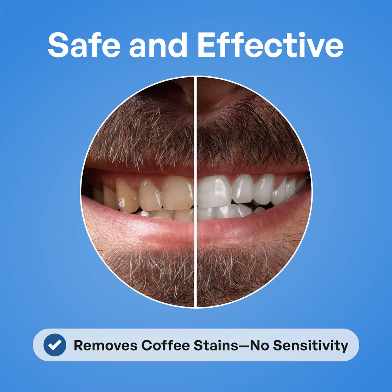 ShineFoam Whitening Foam | Teeth Whitening Foam - Image 3