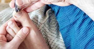 how-to-get-rid-of-thick-toenails