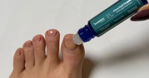 how-to-treat-nail-fungus-easily