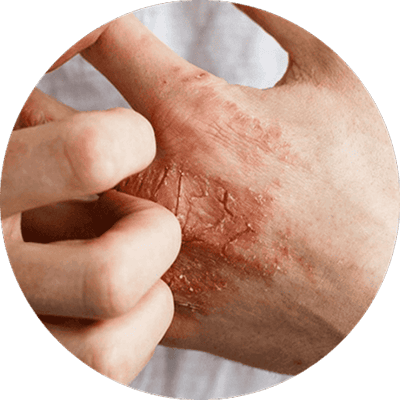 Joint pain