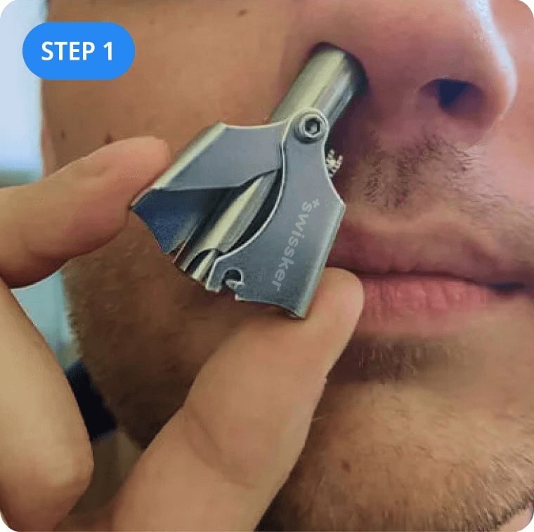Ingrown Toenail
