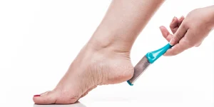 Athlete's Foot vs Dry Skin: comparison