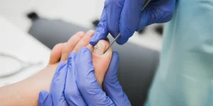 How to Avoid Ingrown Toenails