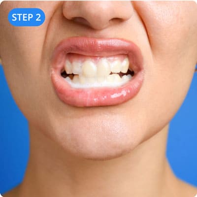 Step 2