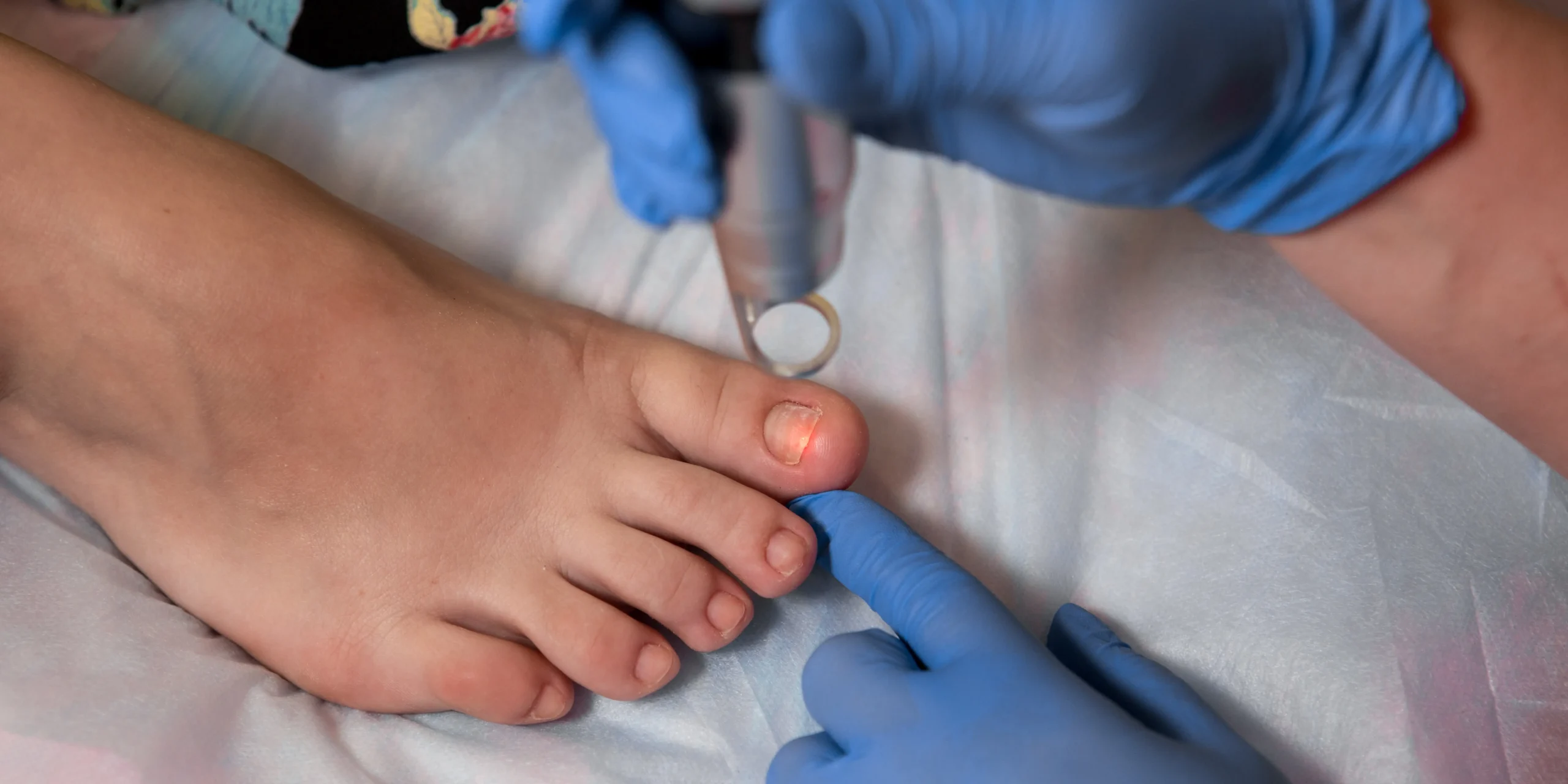 What Causes Thick Toenails