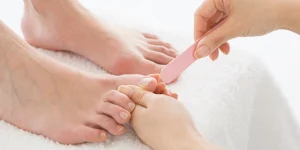 Nail Fungus vs Subungual Melanoma