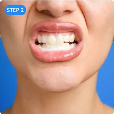 Step 2