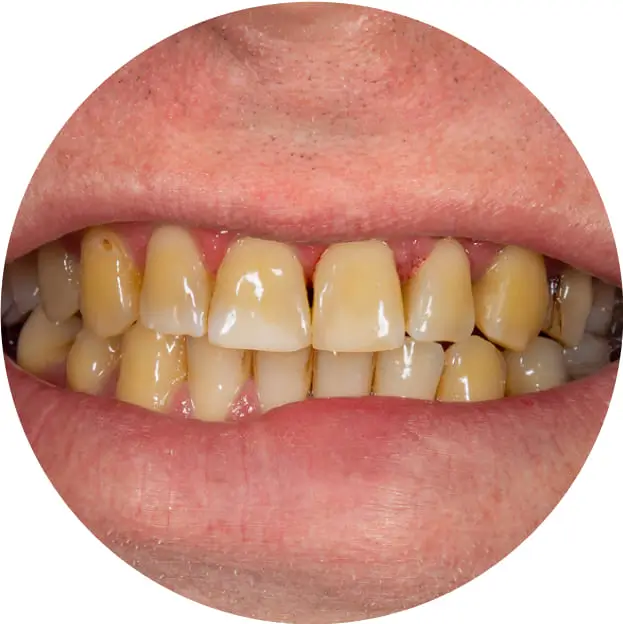 Wife or girlfriend making a face