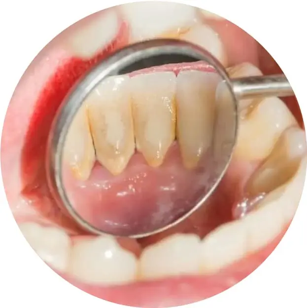 Embarrassing photos & videos